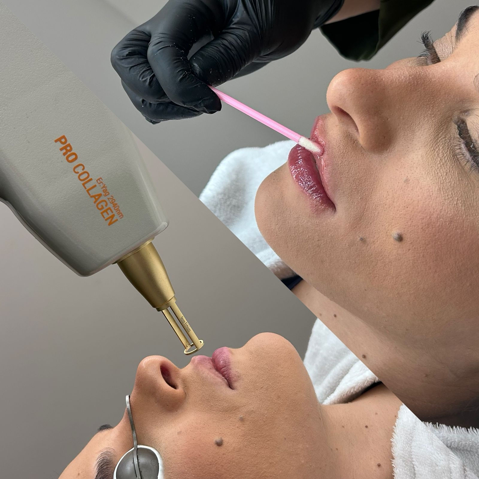 Protocolo Lábios Care - Nutra Gloss com Voluma Lips