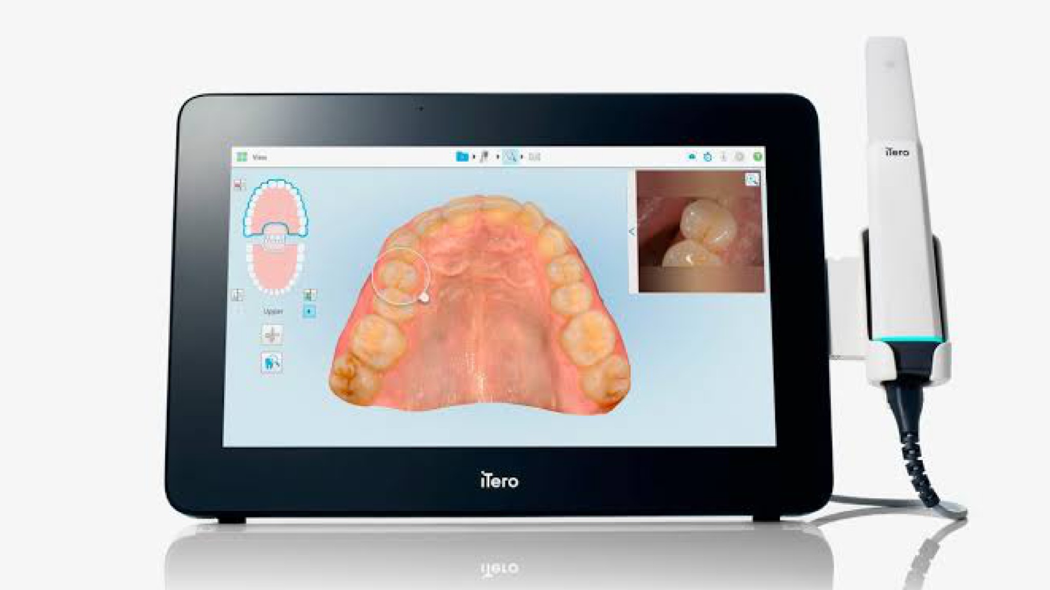 iTero Lumina Mobile intraoral scanner
