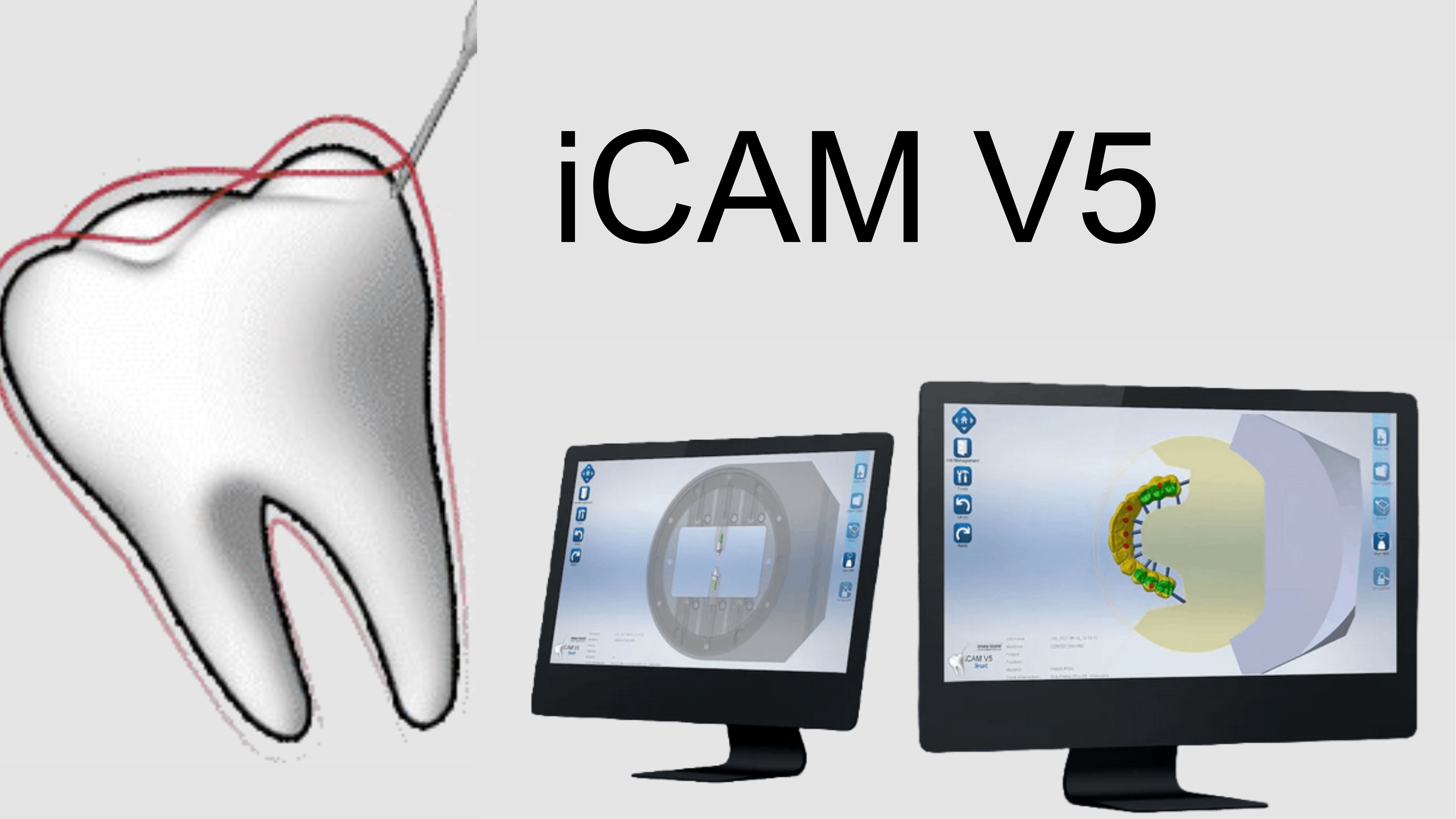 imes-icore iCAM V5 dental CAD/CAM milling software for 5-axis dental restorations