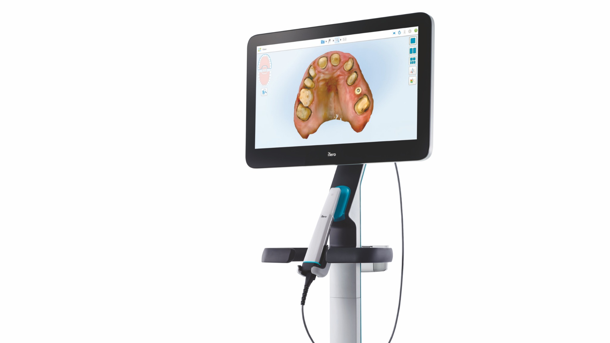 iTero Lumina Cart intraoral scanner on mobile cart workstation