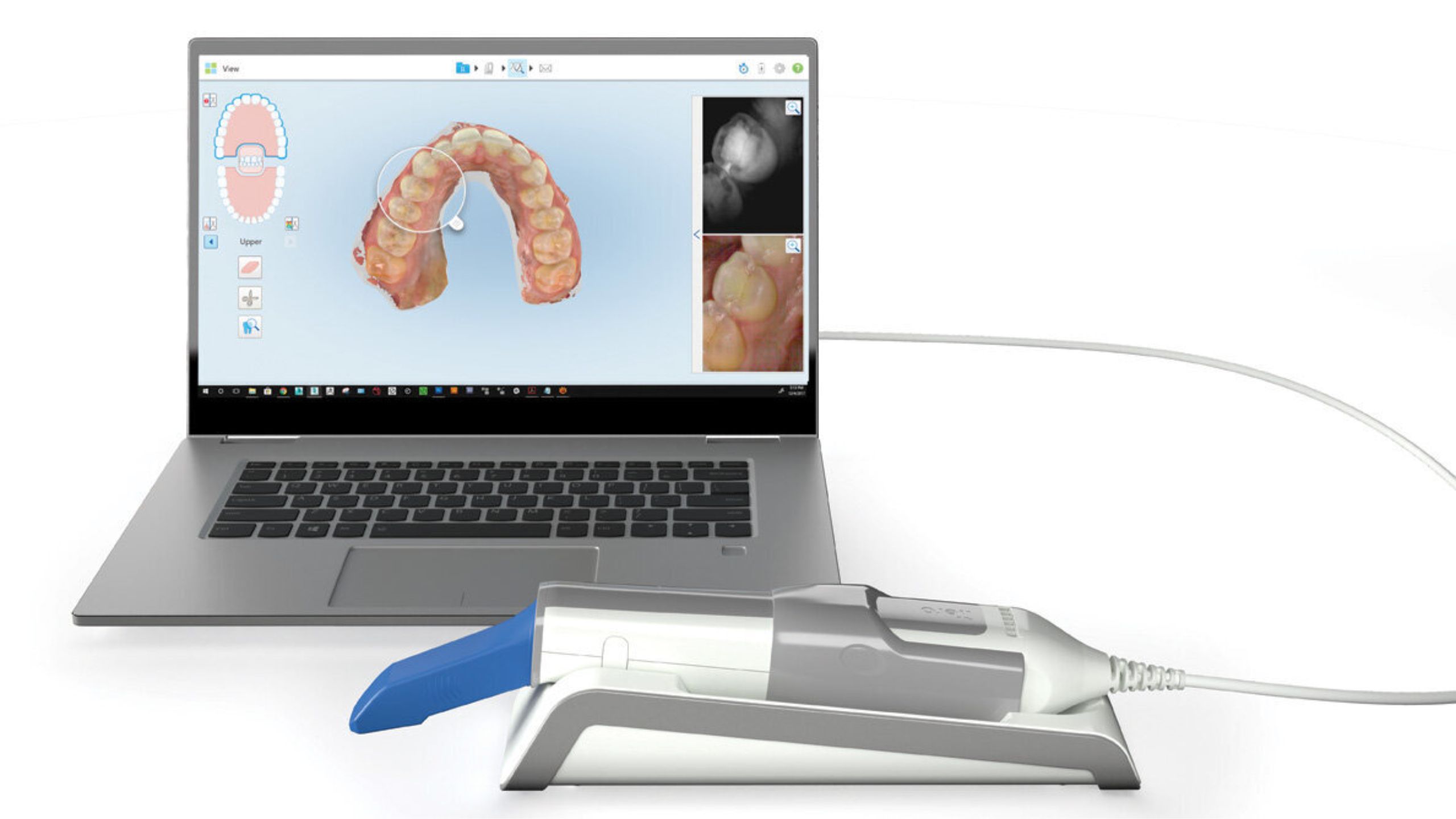 iTero Element 5D intraoral scanner for digital dental impressions and chairside workflows