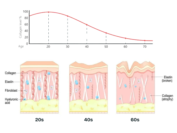 collagen deterioration over time