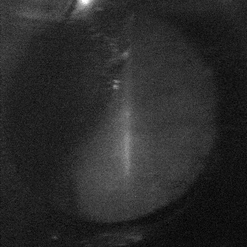 An ear drum image seen throguh OCT