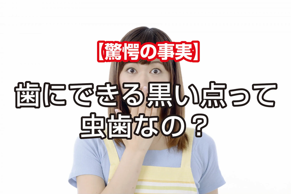 驚愕の事実 歯にできる黒い点って虫歯なの