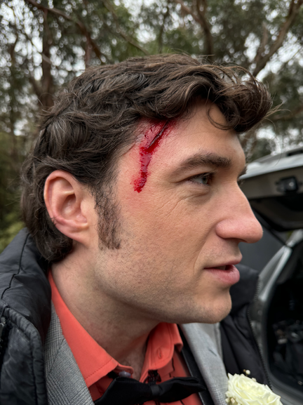 The Wedding Day Scar