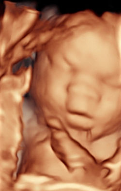 sleeping with mouth open