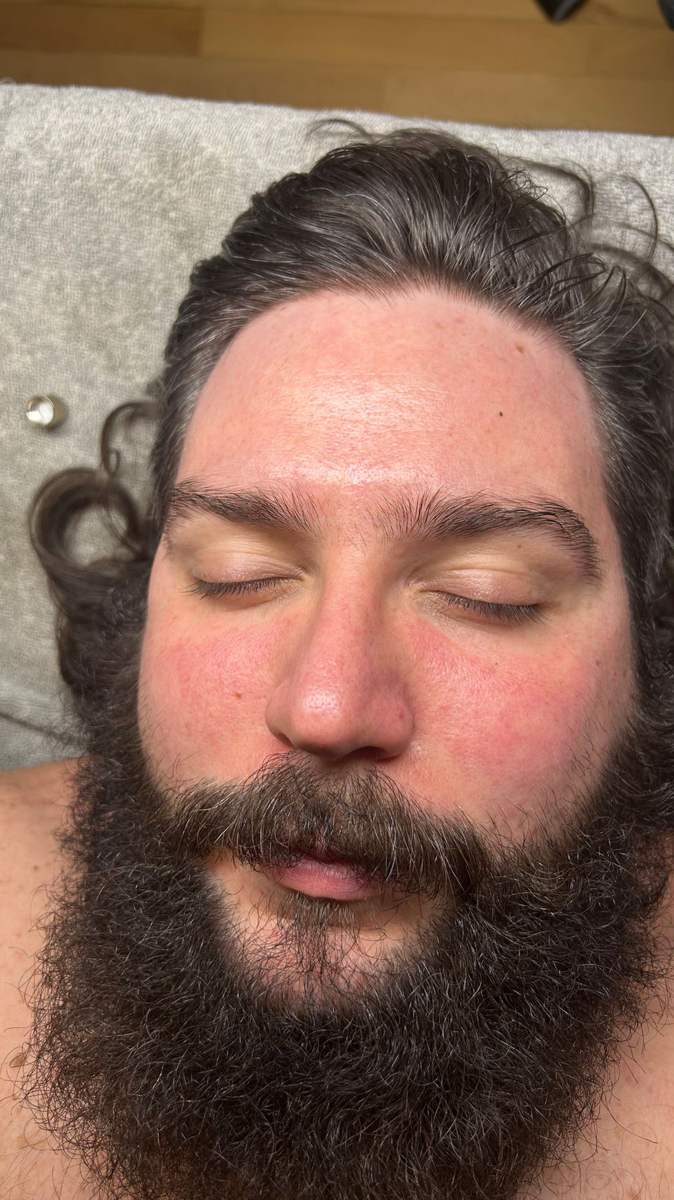 Dermabrasion