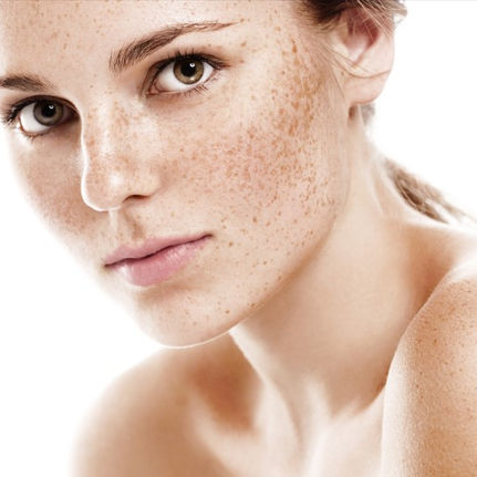 Resolve Fusion - Pigmentation.jpg