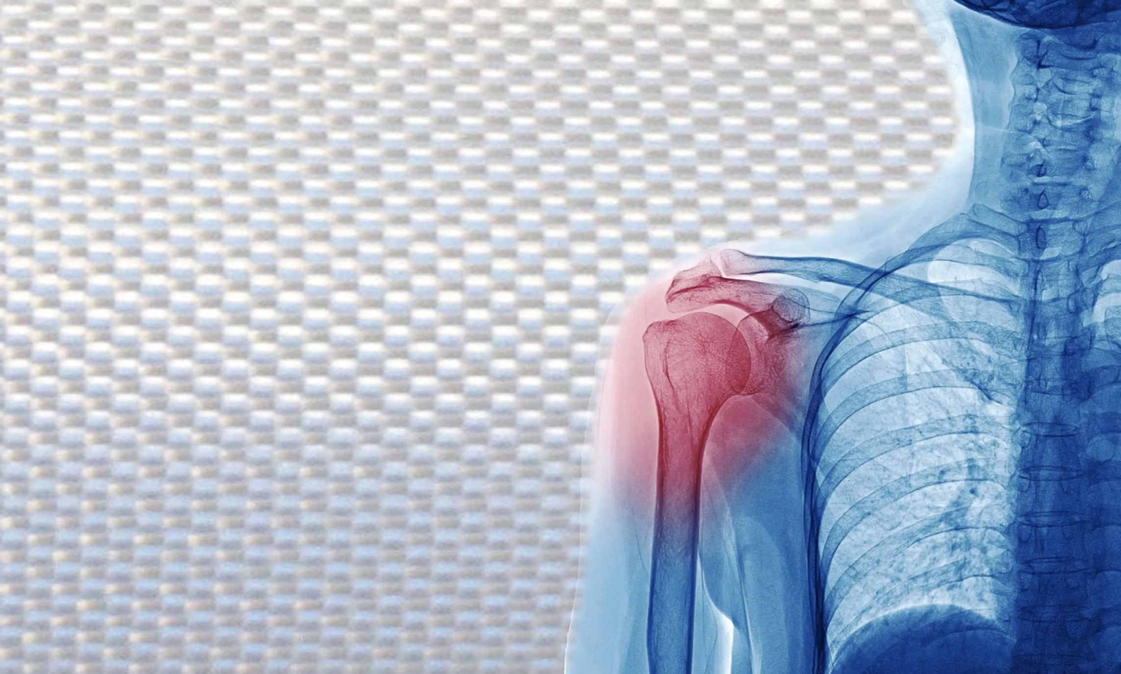 Shoulder skeleton 2.jpg