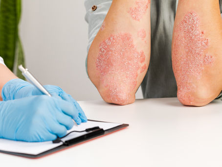 Gloved clinician writes on a clipboard beside a patient’s scaly psoriasis patches on both forearms in a clinic setting