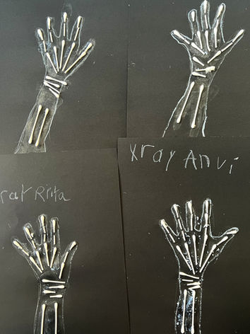 Four drawings of skeletal hands with x-ray Anvi, Rita, Niga