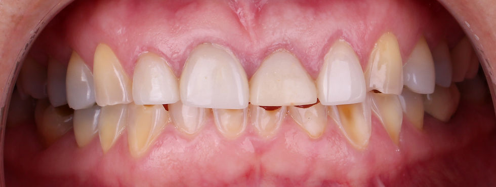 Complete Advanced Dentistry