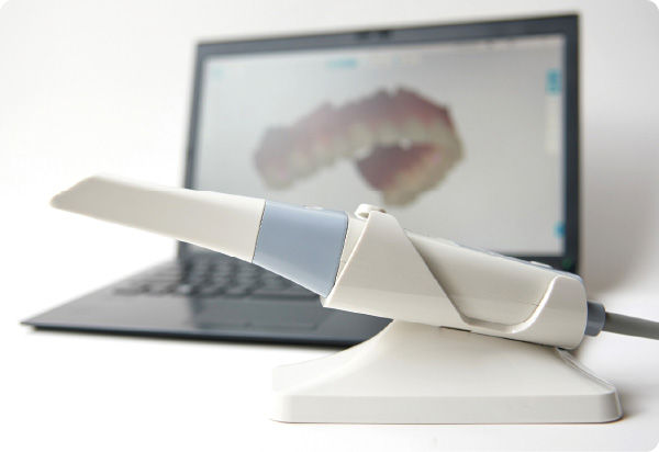 口腔内スキャナー