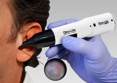 Миниатюра: Oтоскоп PRo Wireless