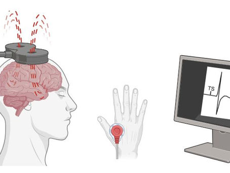 Medidas de excitabilidade cortical por estimulação magnética transcraniana