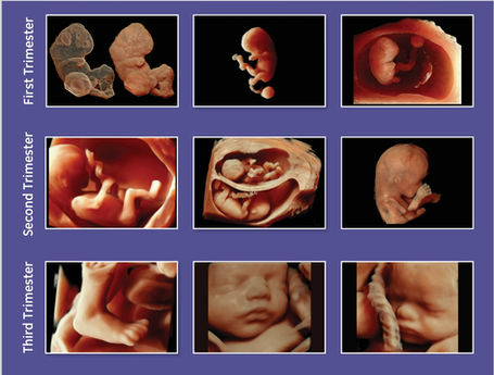 A variety of ultrasound images