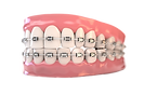 braces 3d-PhotoRoom.png-PhotoRoom.png