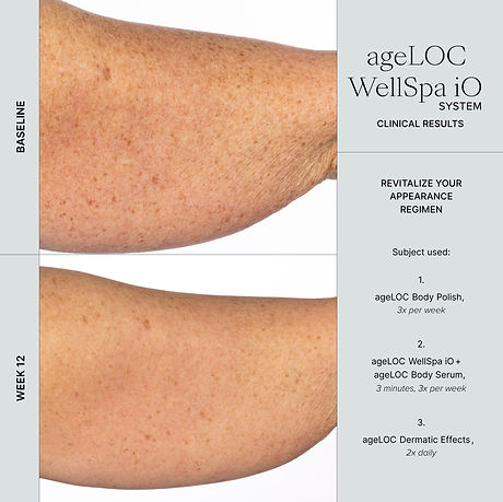 WellSpa iO before after 3min 3x arm 2.jpg
