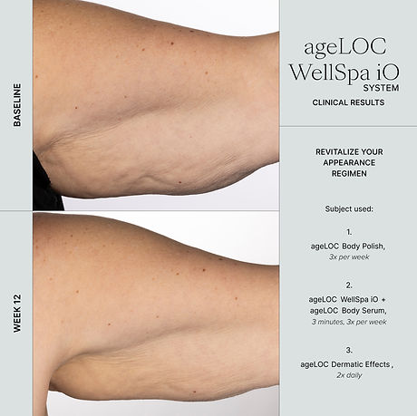 WellSpa iO before after 3min 3x arm.jpg