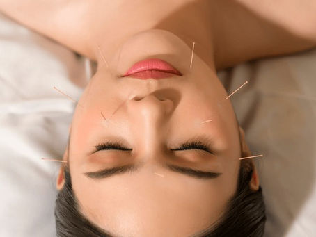 Rinita alergică. Rinita vasomotorie. Tratamentul alternativ cu acupunctura.