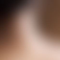 Acupunctura pentru Sănătatea Ta.