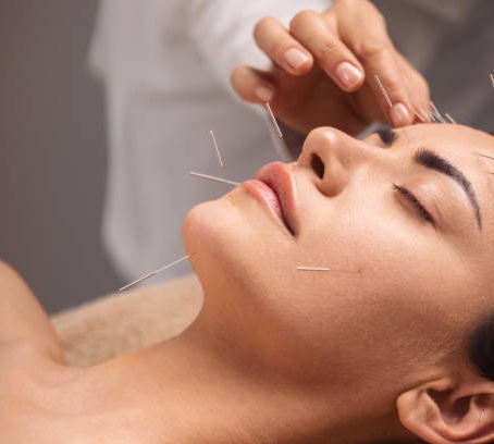 NEVRALGIA DE NERV TRIGEMEN. Tratamentul alternativ cu acupunctură.