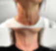 Polys Pigmentation