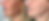 lumecca-before-after-8445-med-spa-preview-1.png
