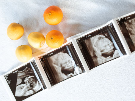 Nutrition, Exercise, and Stretches: Lifestyle Tips for Increasing Fertility