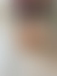 🦶🏻Chodzenie na palcach u dziecka🦶🏻