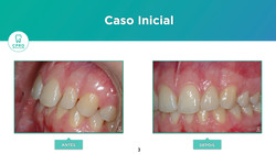 Estética Dentária
