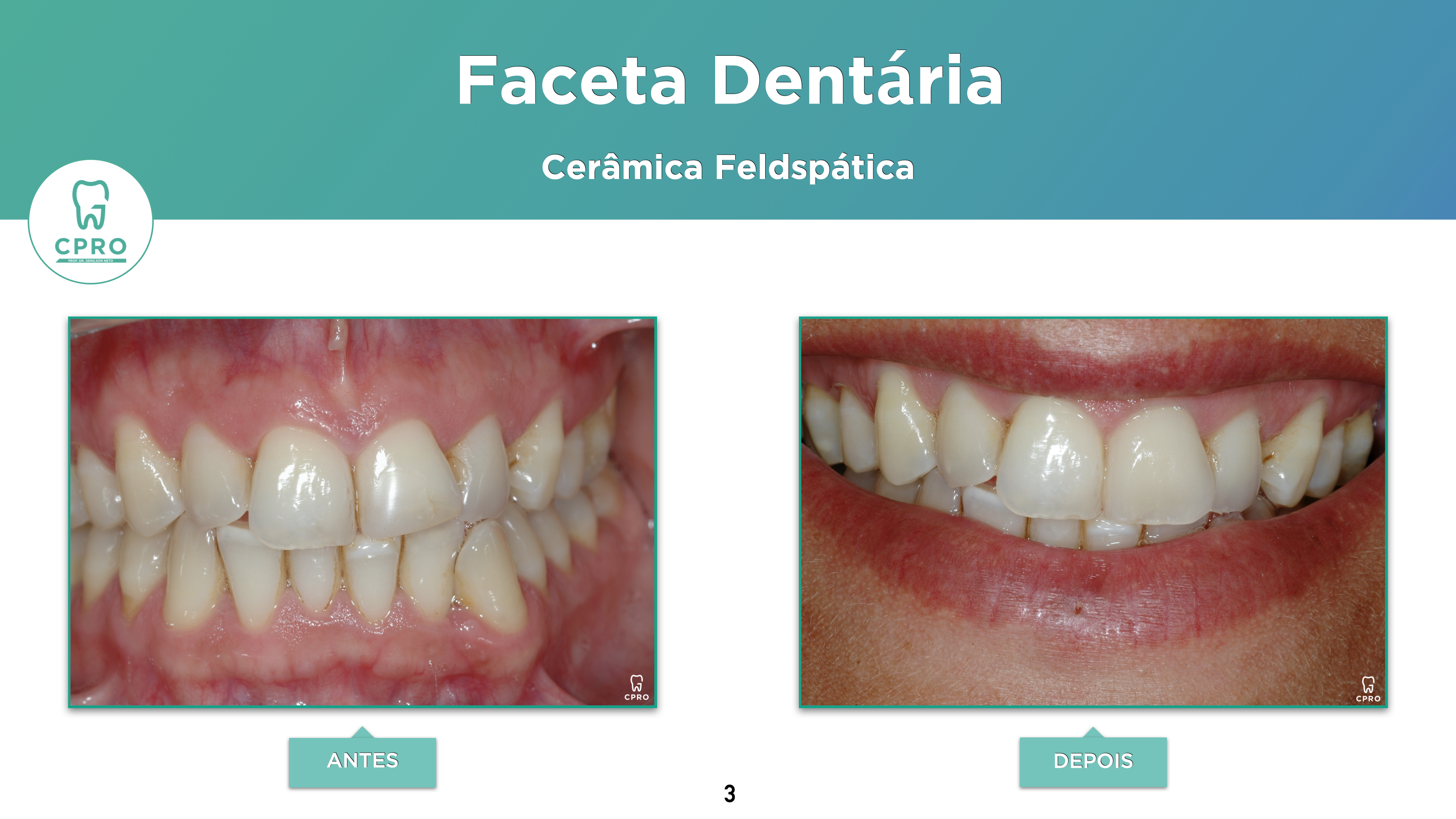 Estética Dentária