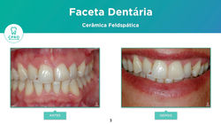 Estética Dentária
