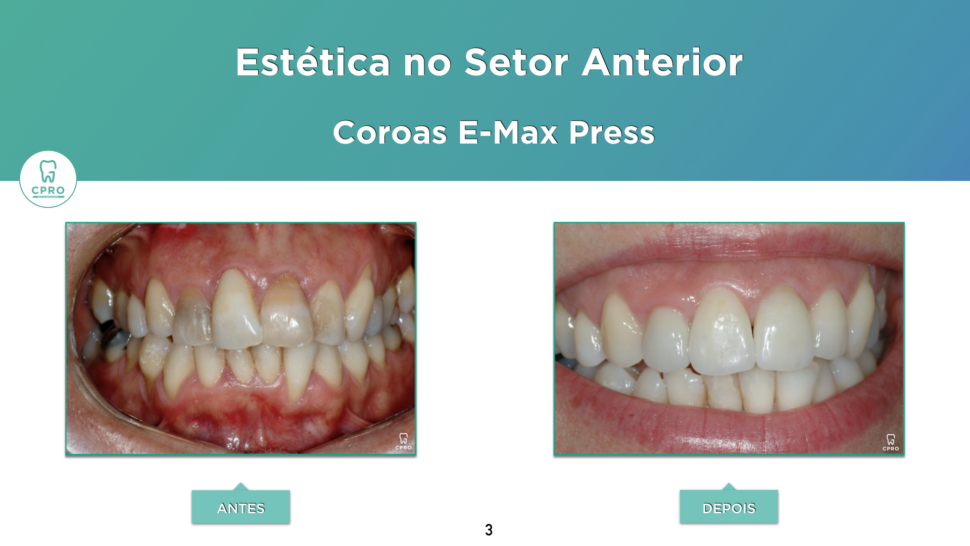 Estética Dentária