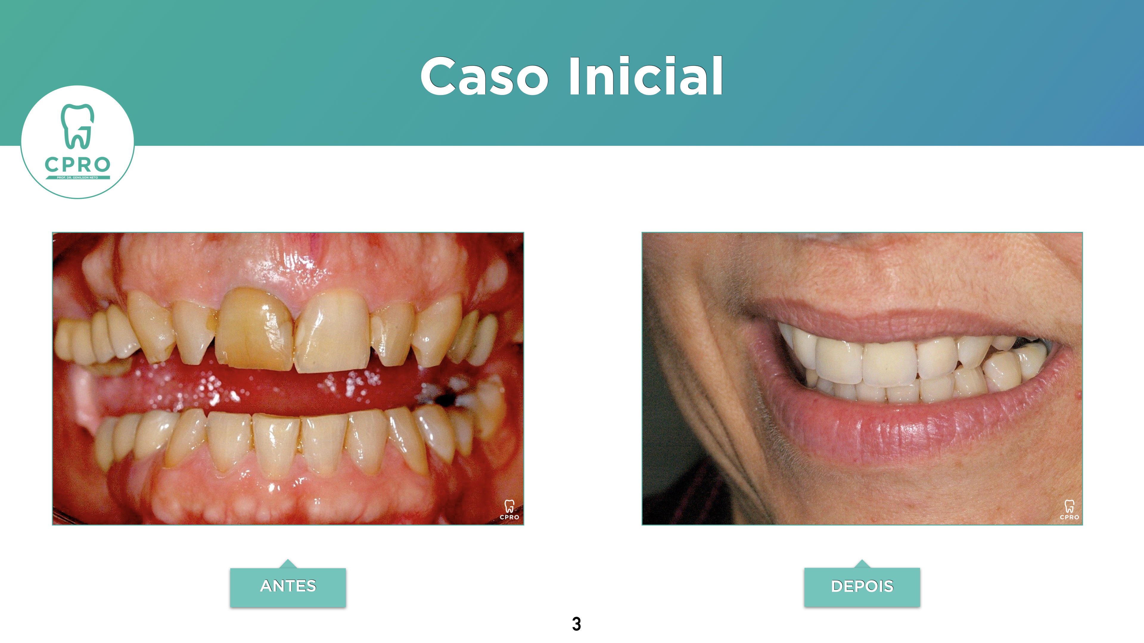 Estética Dentária