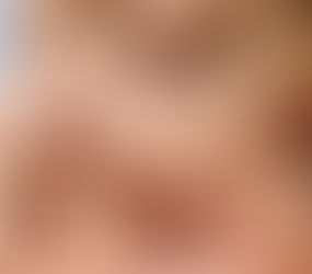 Amazing benefits of Nanotox