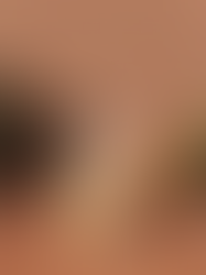 Why You Can Drink Water and Still Be Dehydrated