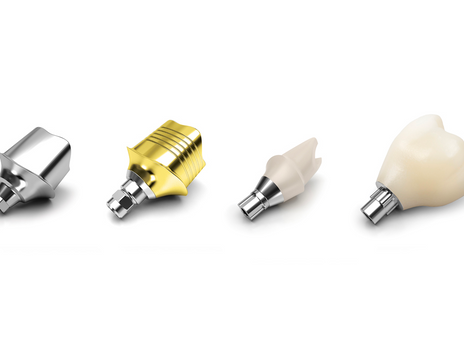 Abutment Set.png