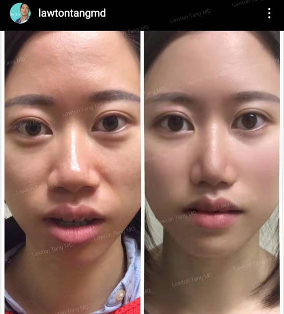 Plastic surgery 1.jpg