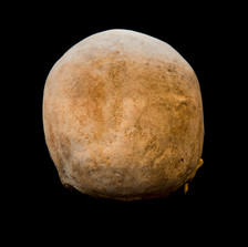 Age determination of a skull