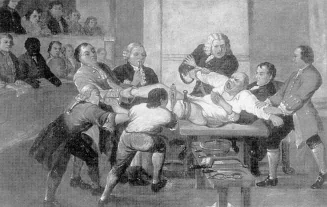 leg amputation in 1775