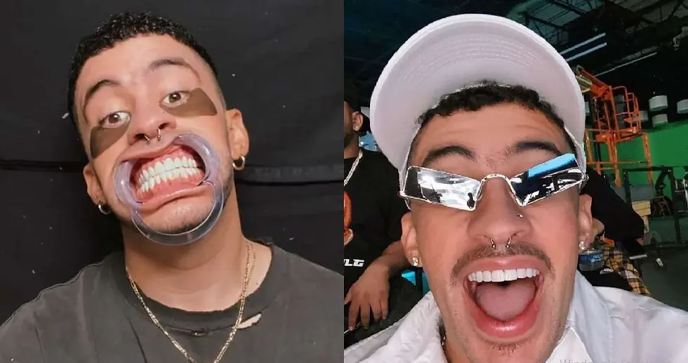 ¿Por qué Bad Bunny se arrepiente de colocarse carillas?  Lo que debes saber si estás pensando en ponértelas.