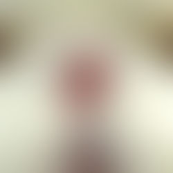 Les sténoses de narines chez le persan