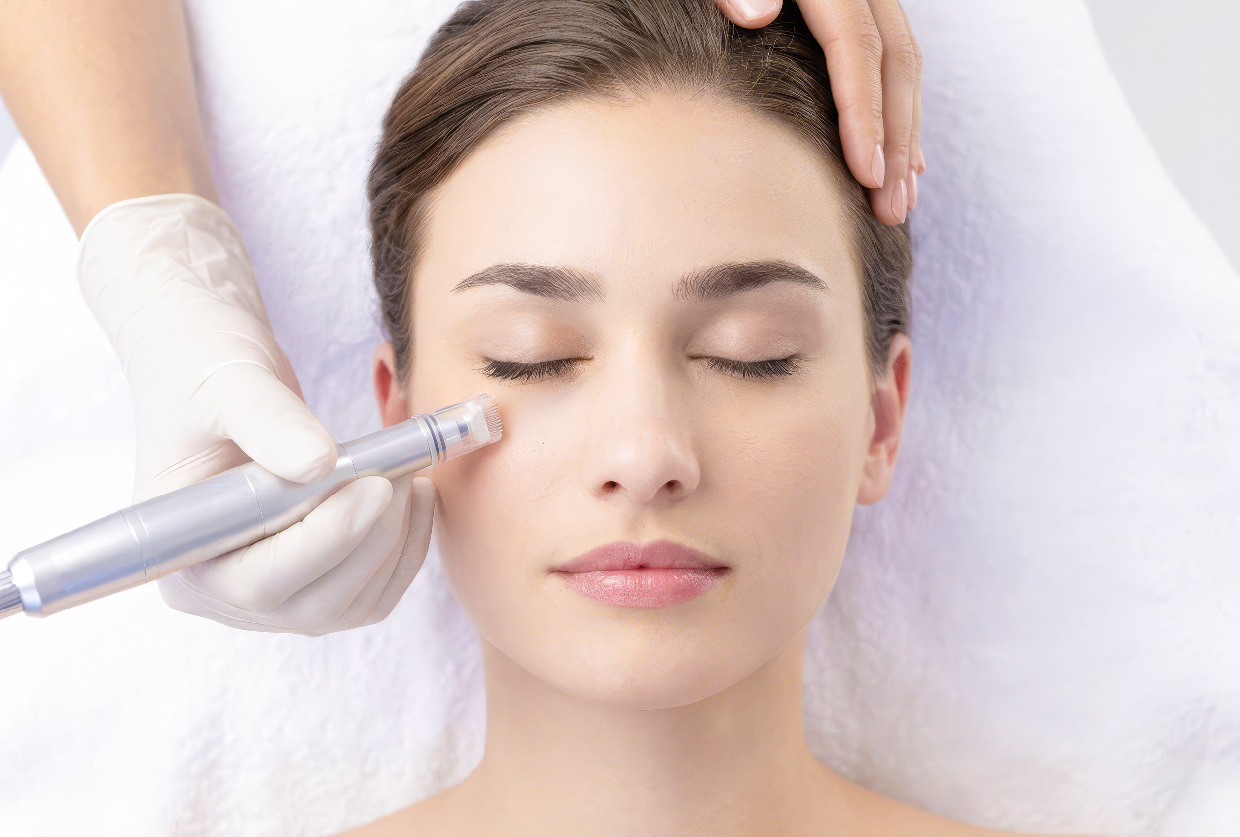 Behandlung einer Kunding mit dem neuen REVIDERM Micro-Needling-Verfahren