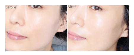 Thumbnail: Azulene Relief Solution Ampoule 50ml
