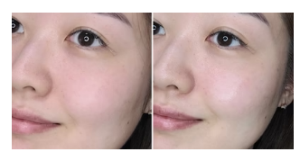 Thumbnail: Hyal-Moisture Solution Ampoule 50ml