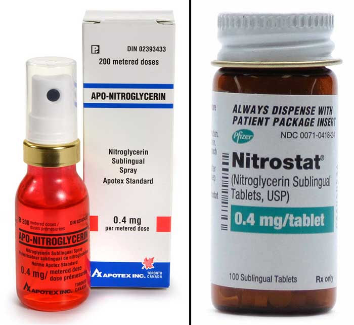 Doctor, I am feeling Chest Pain