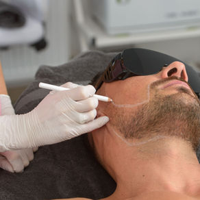 Laser Hair Removal for Men in Devon: Is It Time to Ditch the Razor for Good?