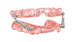 sleep apnea appliance at Jonathan K. Dav