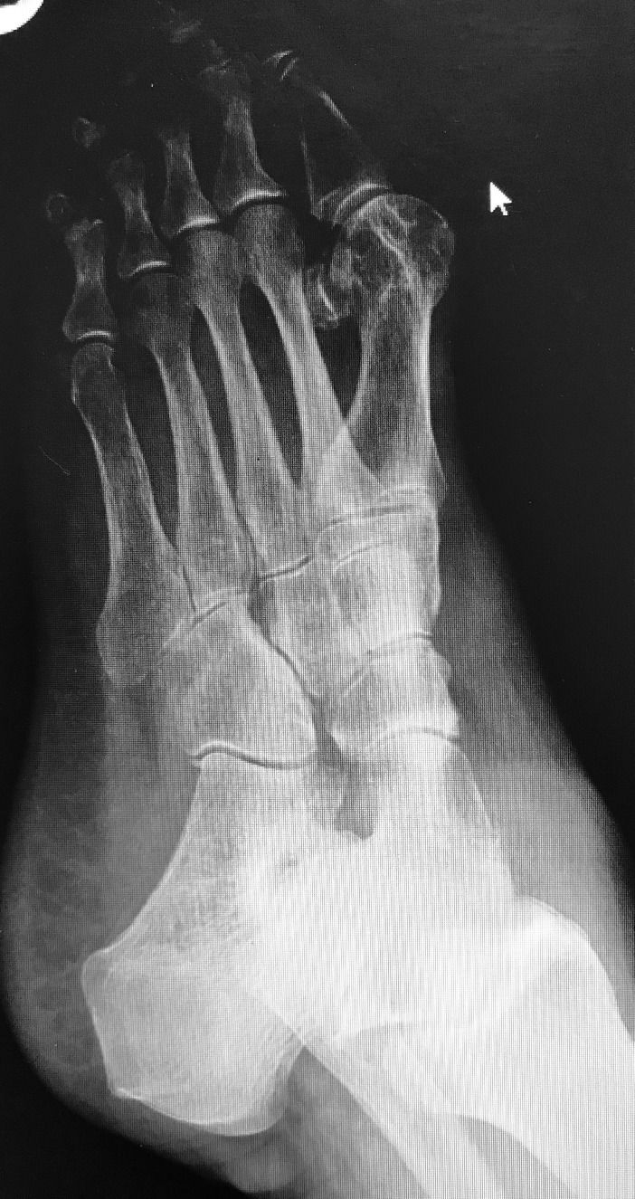 Before Surgery oblique